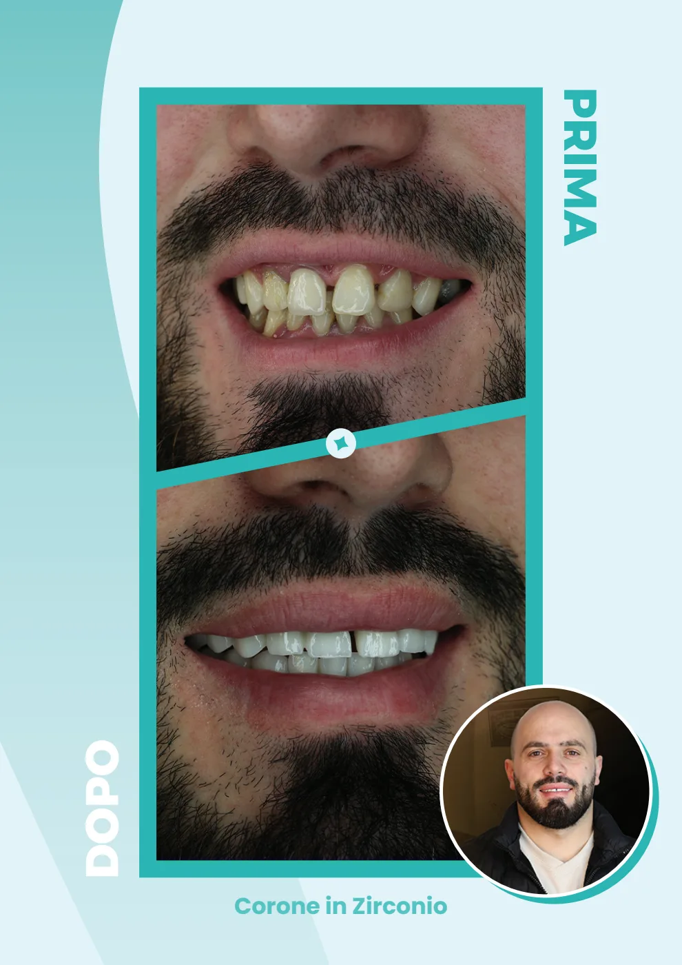Catalogo DentalCare One, pagina 11