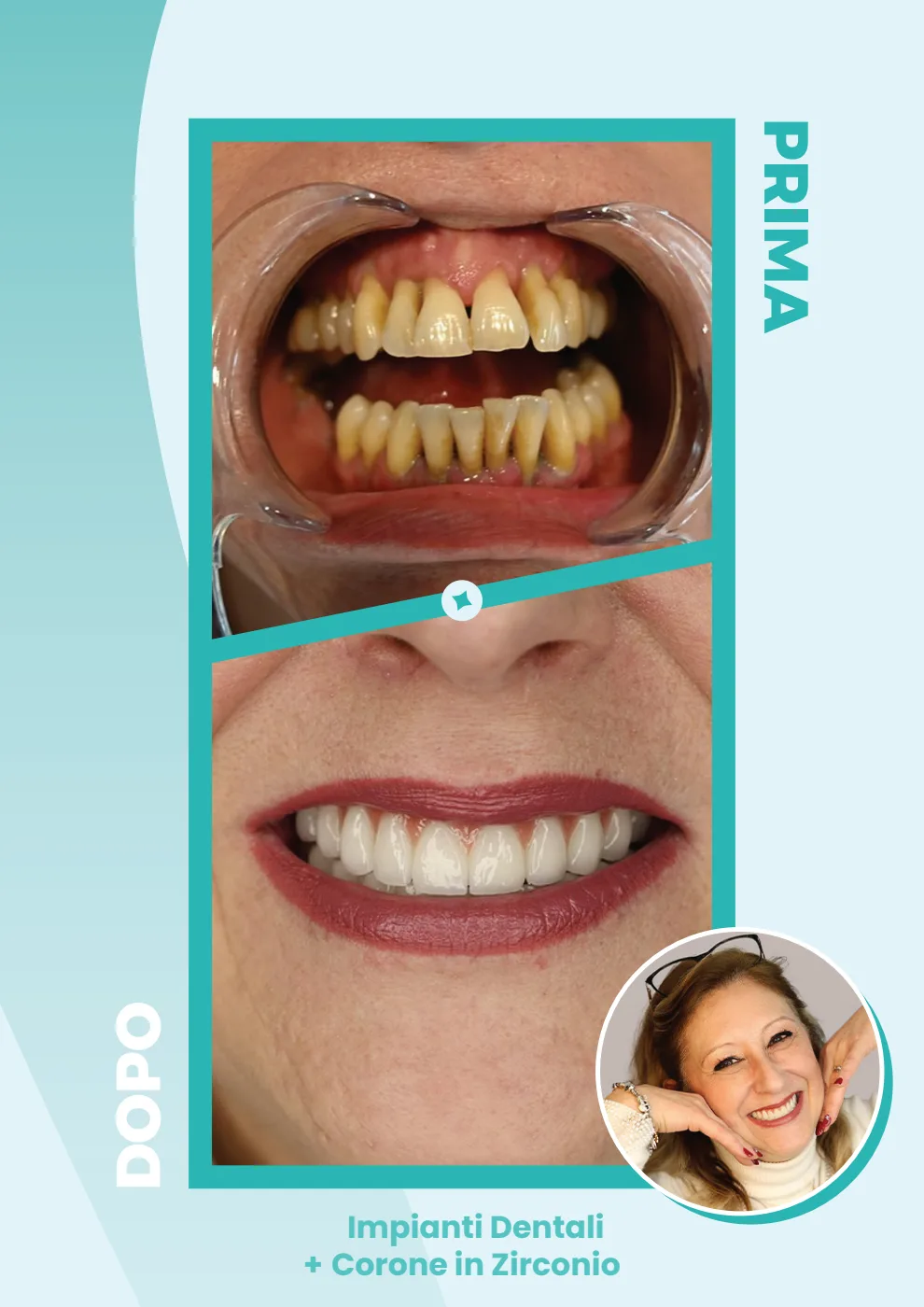 Catalogo DentalCare One, pagina 12