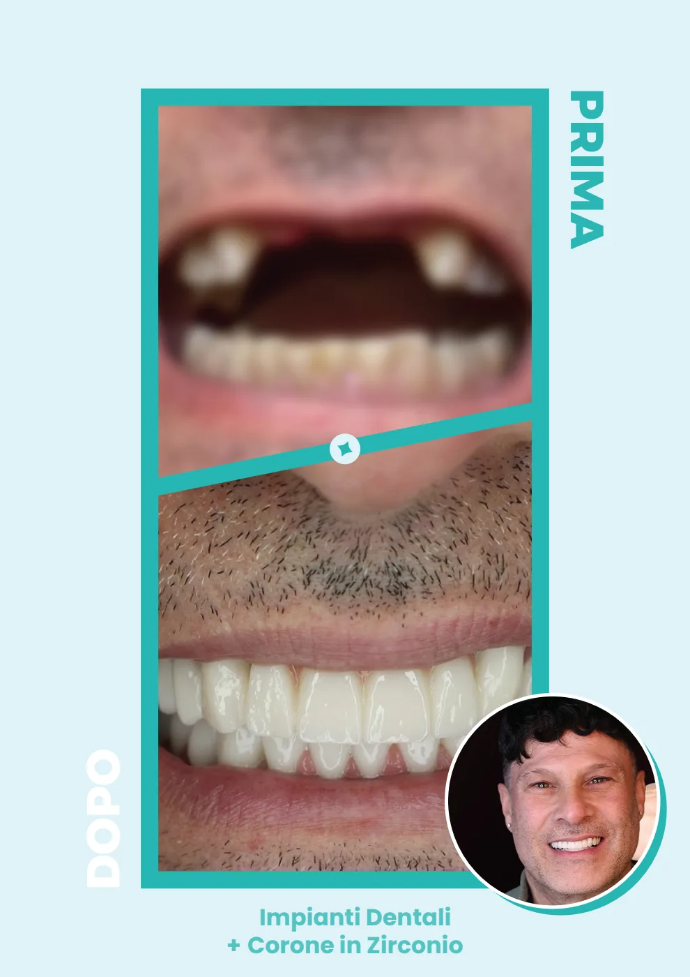 Catalogo DentalCare One, pagina 13