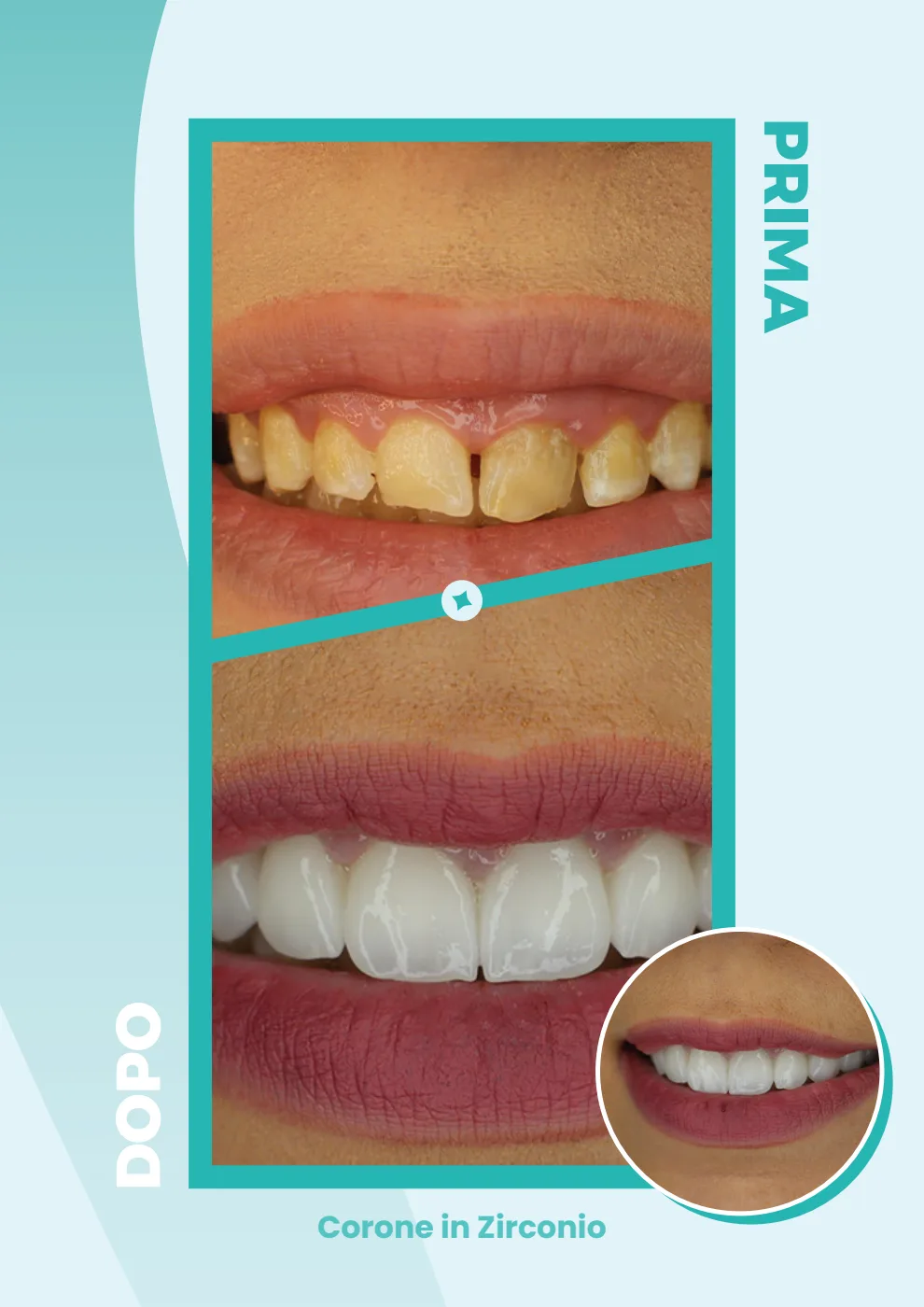 Catalogo DentalCare One, pagina 14