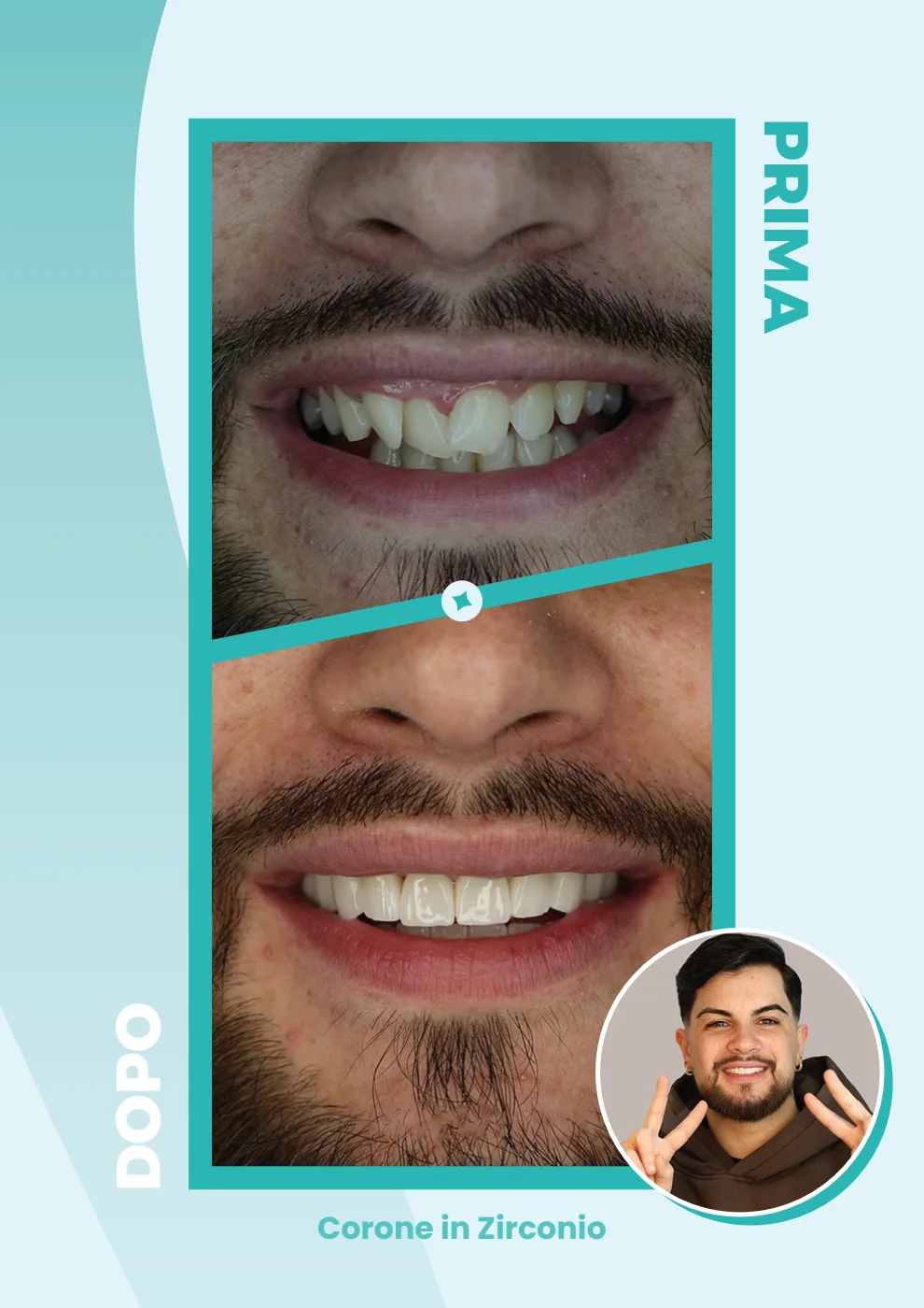 Catalogo DentalCare One, pagina 15