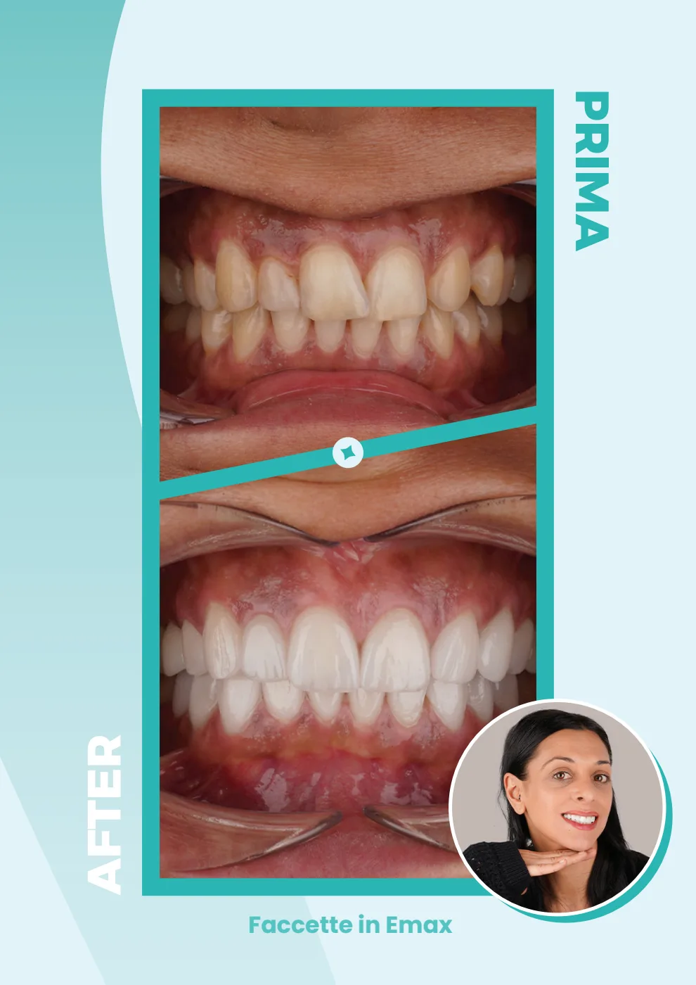Catalogo DentalCare One, pagina 16