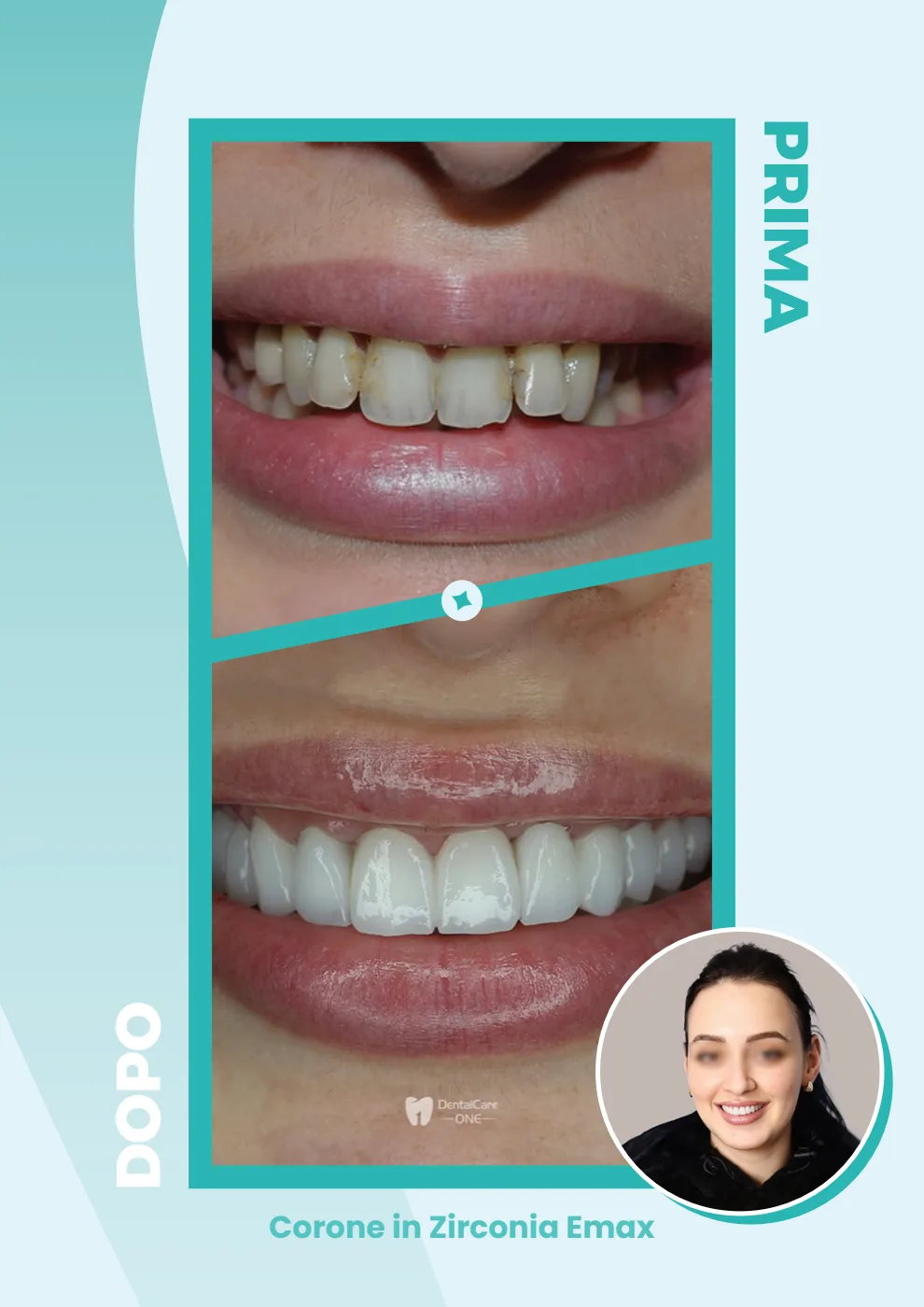 Catalogo DentalCare One, pagina 17