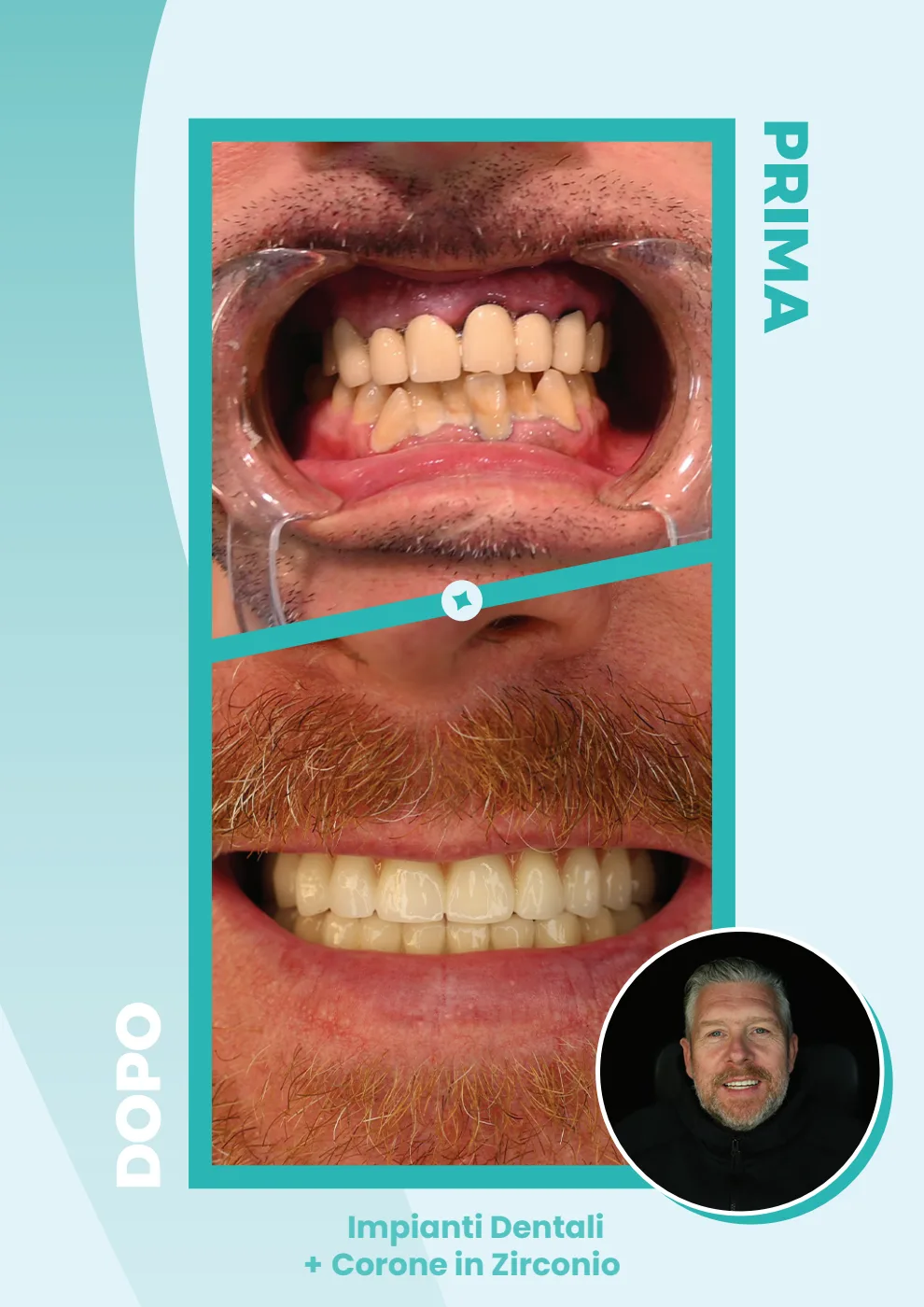 Catalogo DentalCare One, pagina 19