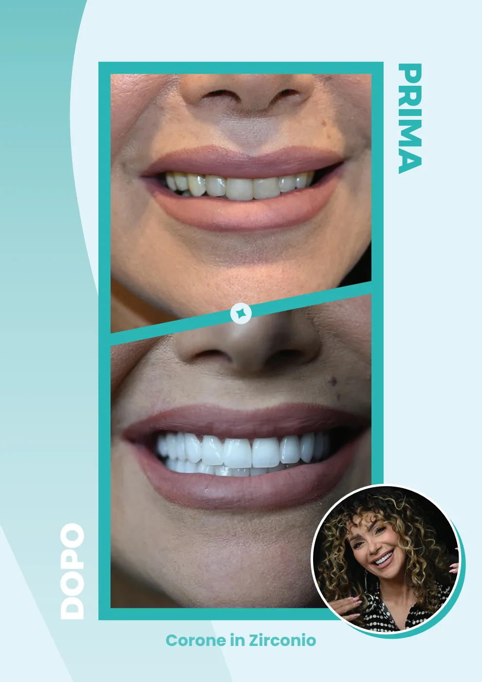 Catalogo DentalCare One, pagina 20