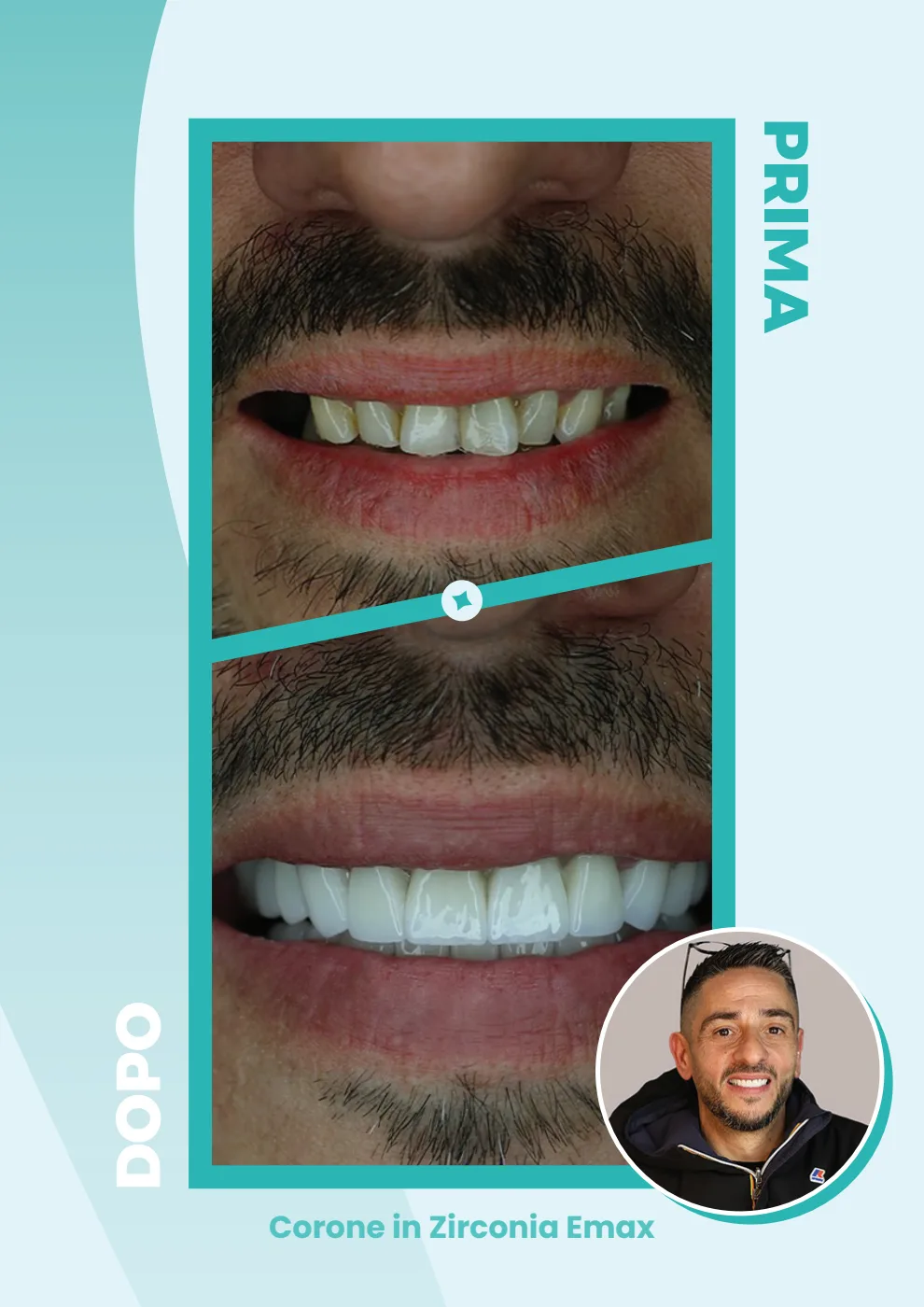 Catalogo DentalCare One, pagina 21