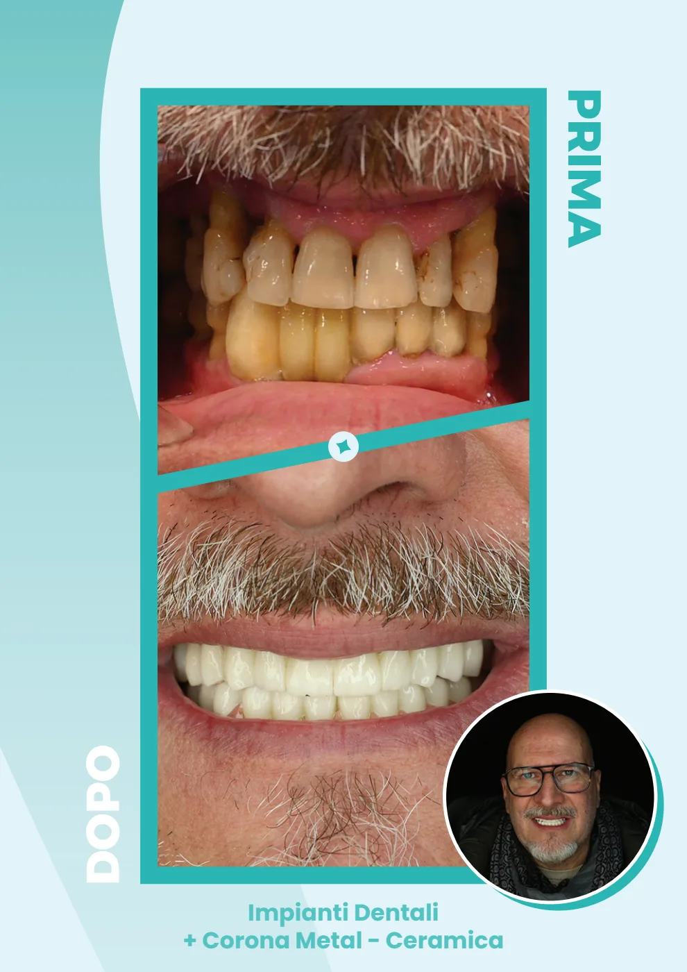 Catalogo DentalCare One, pagina 22