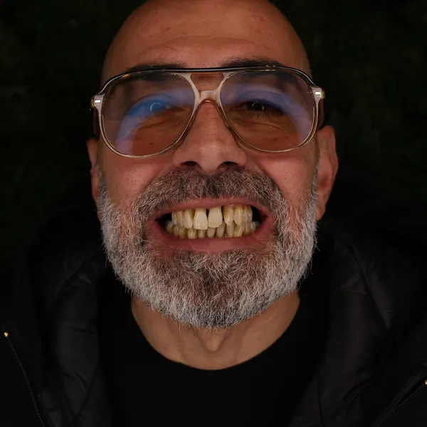 Lo stesso paziente prima del trattamento