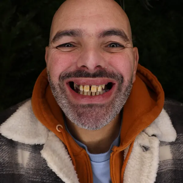 Lo stesso paziente prima del trattamento