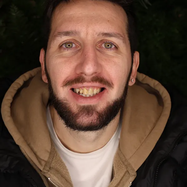 Lo stesso paziente prima del trattamento
